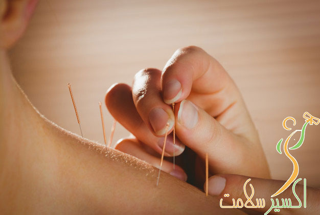 طب سوزنی