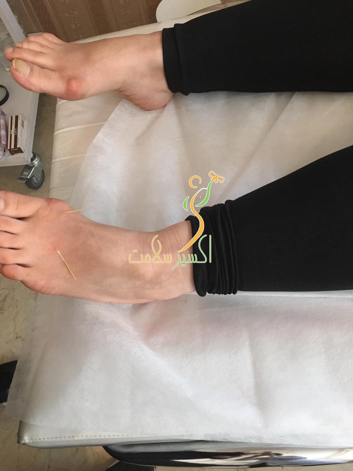 طب سوزنی در  اکسیر شهرک غرب