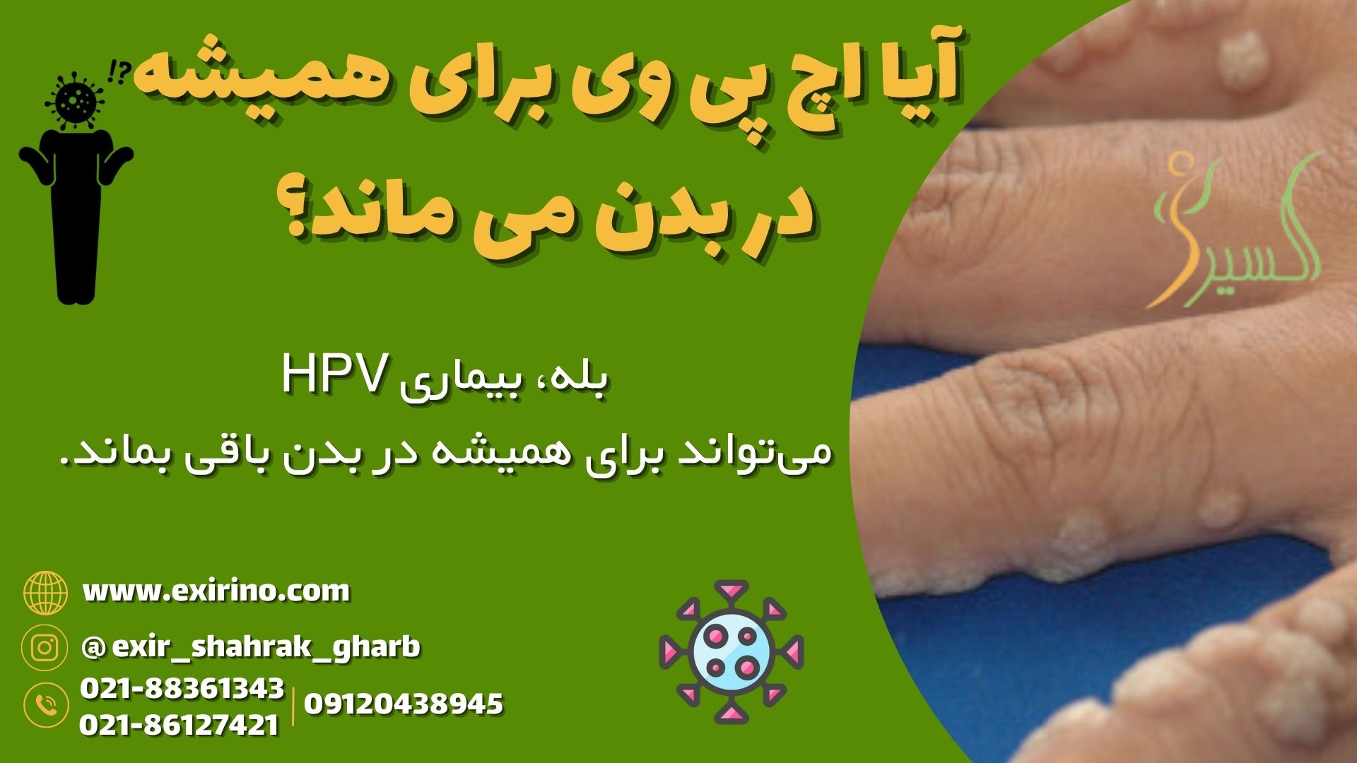 آیا اچ پی وی برای همیشه در بدن می ماند؟