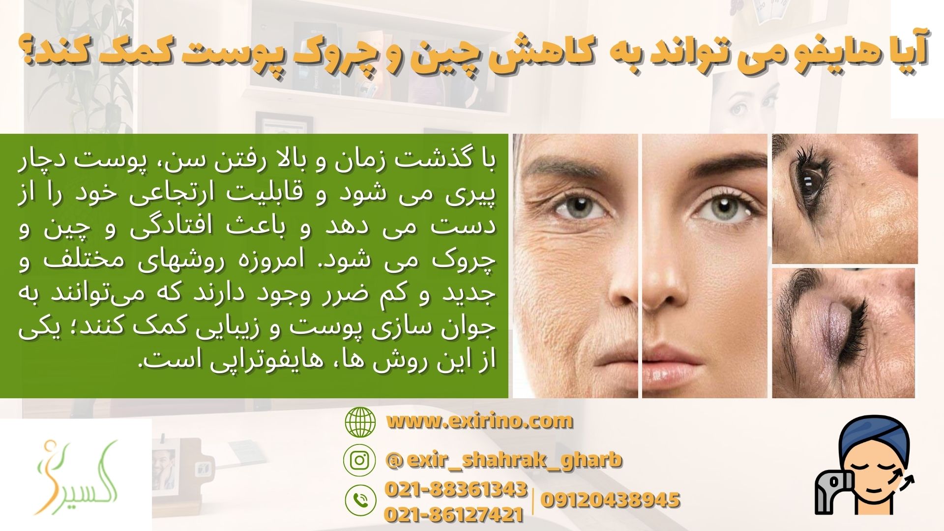 آیا هایفو می تواند به کاهش چین و چروک پوست کمک کند؟