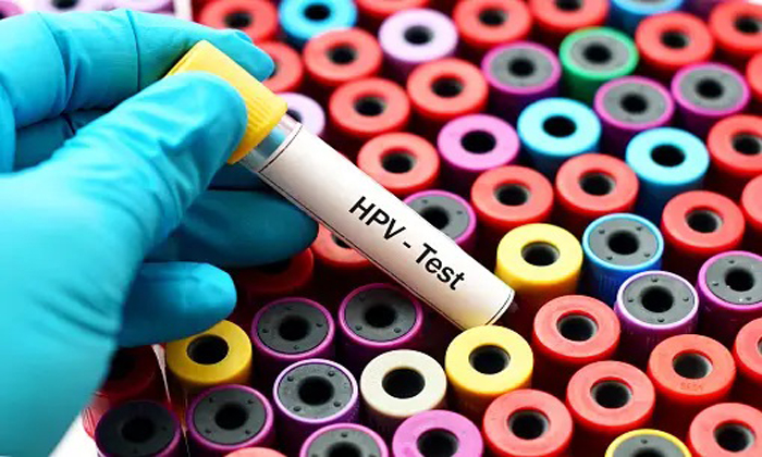همه چیز راجع عفونت HPV