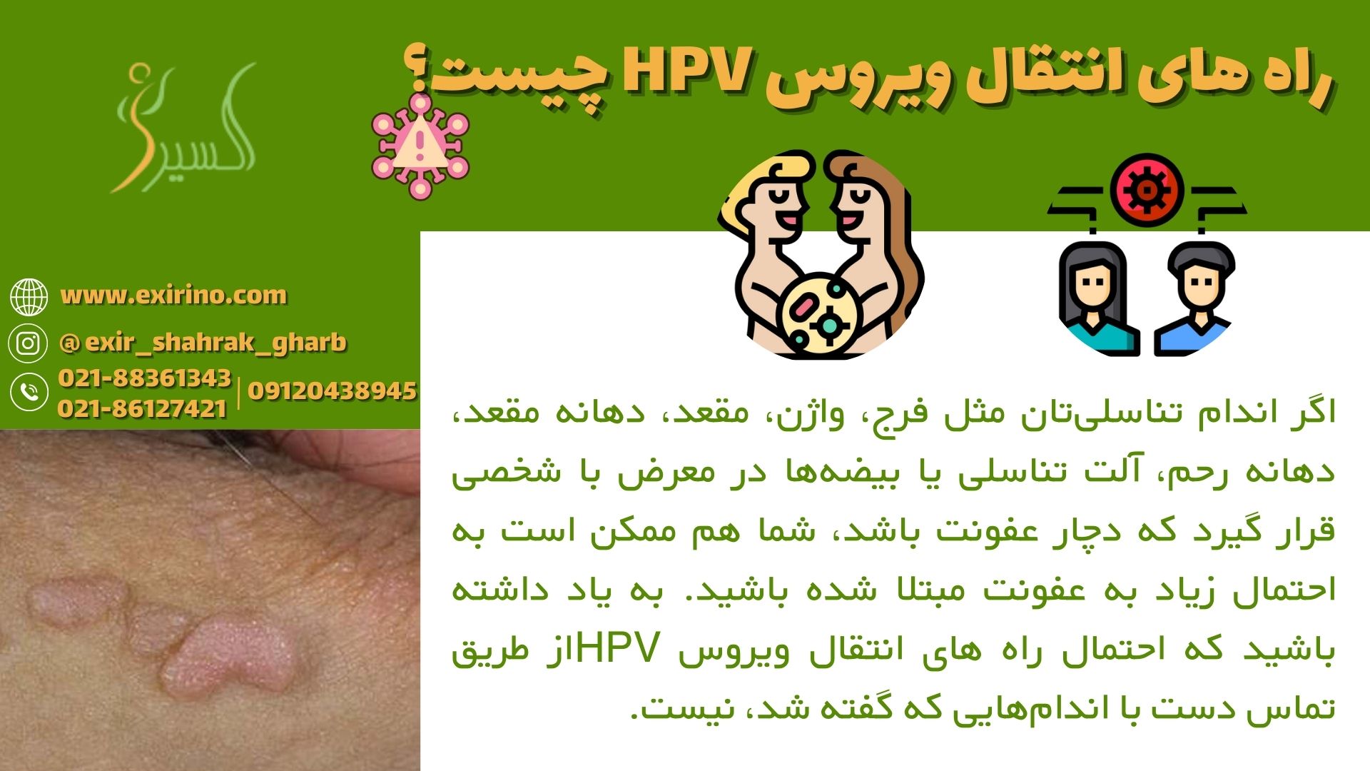 راه های انتقال ویروس HPV چیست؟