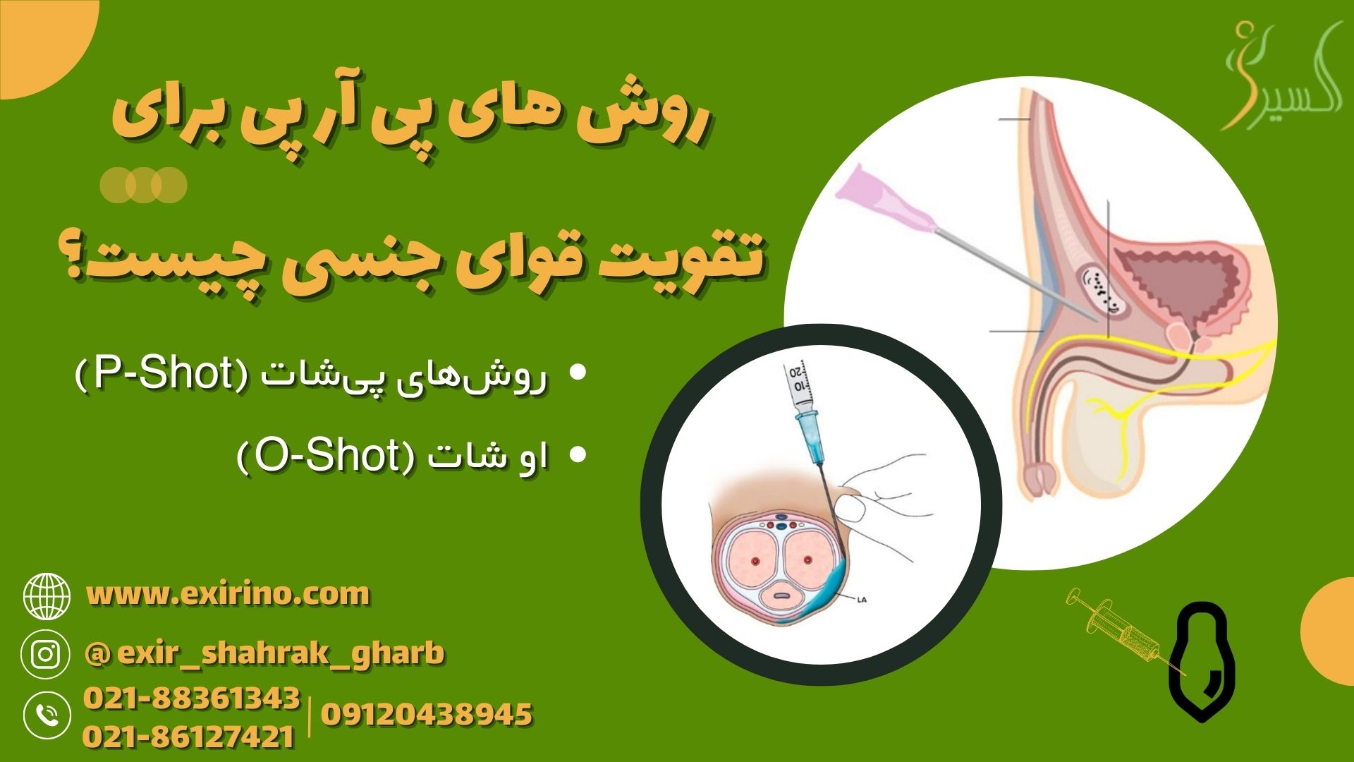 روش های پی آر پی برای تقویت قوای جنسی چیست؟