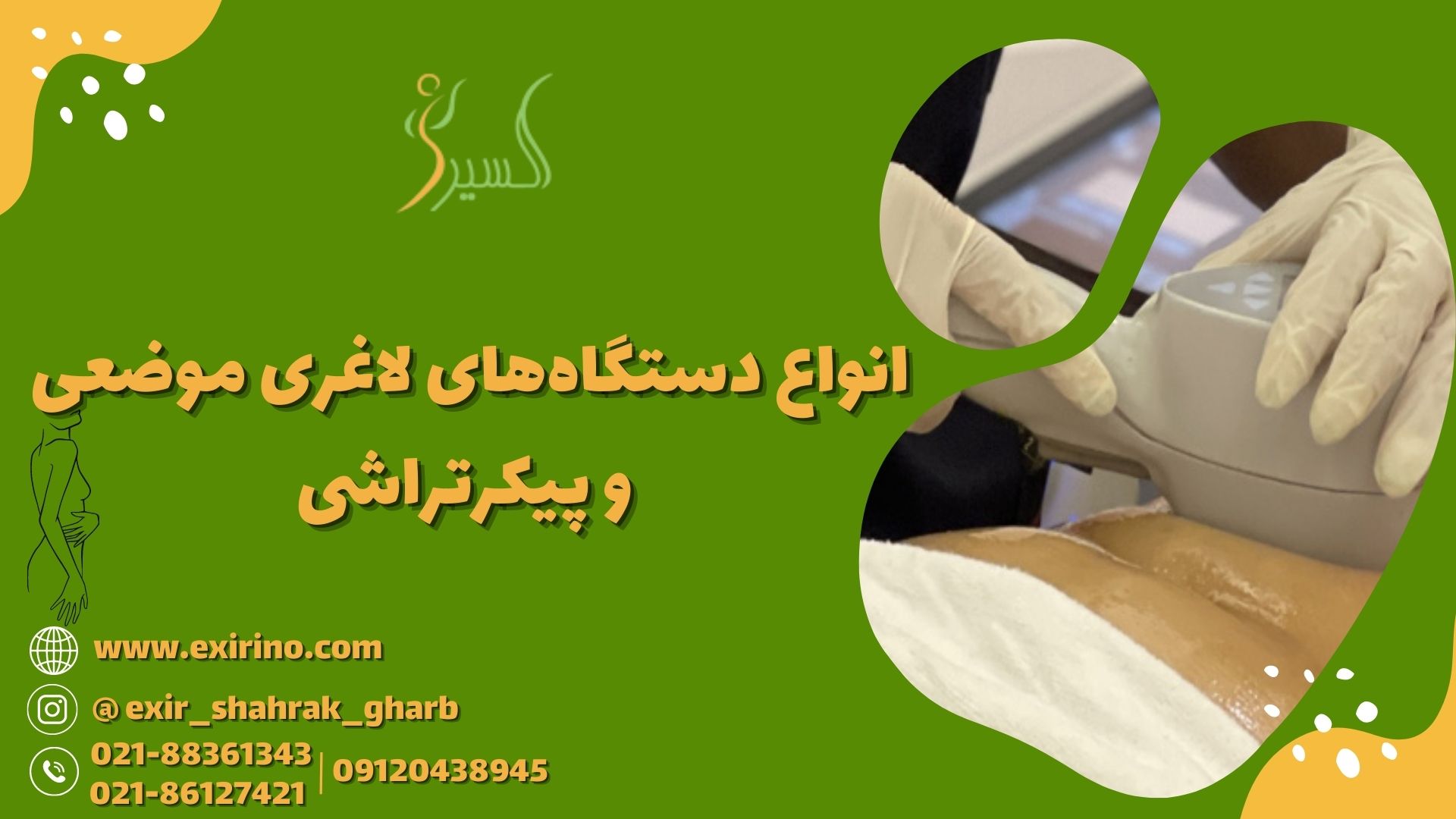 انواع دستگاه‌های لاغری موضعی و پیکرتراشی