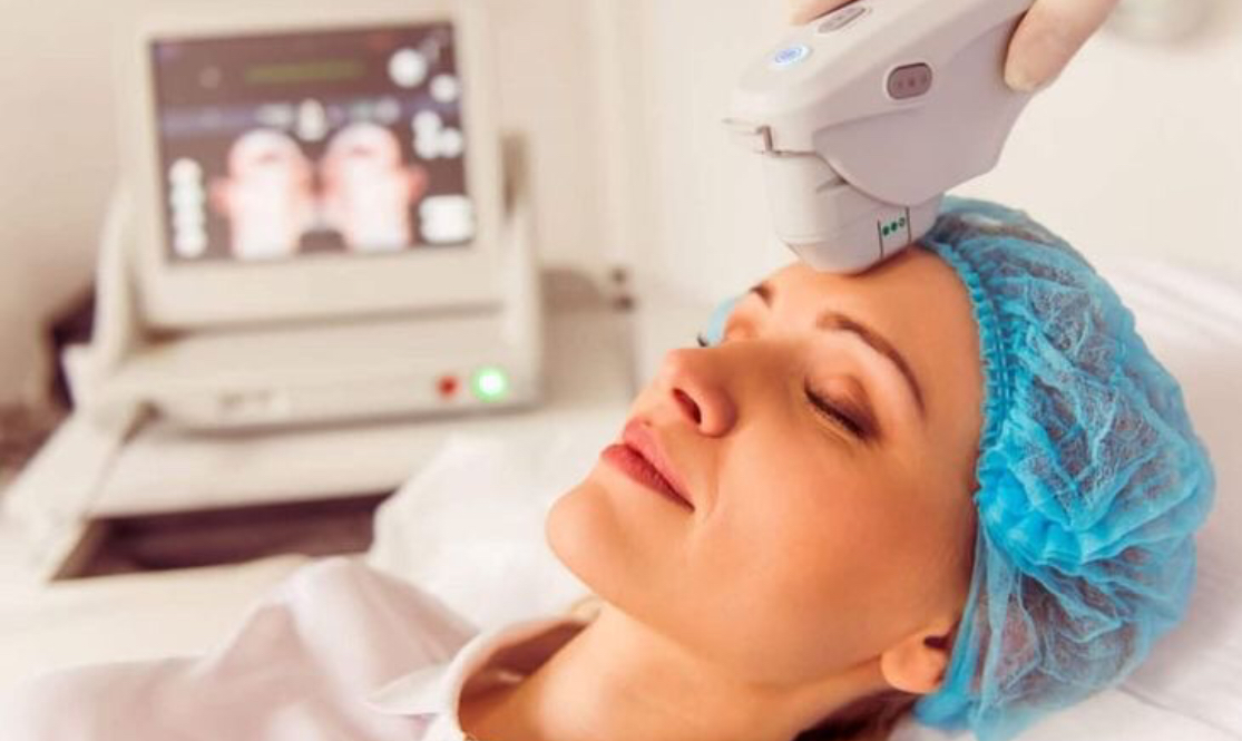 هایفوتراپی، معجزه جوانسازی صورت