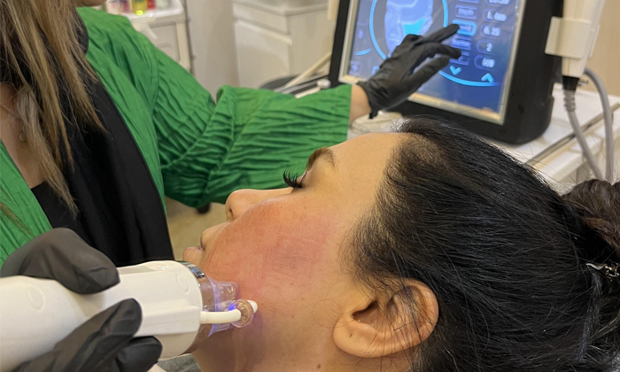 آر اف چیست؟