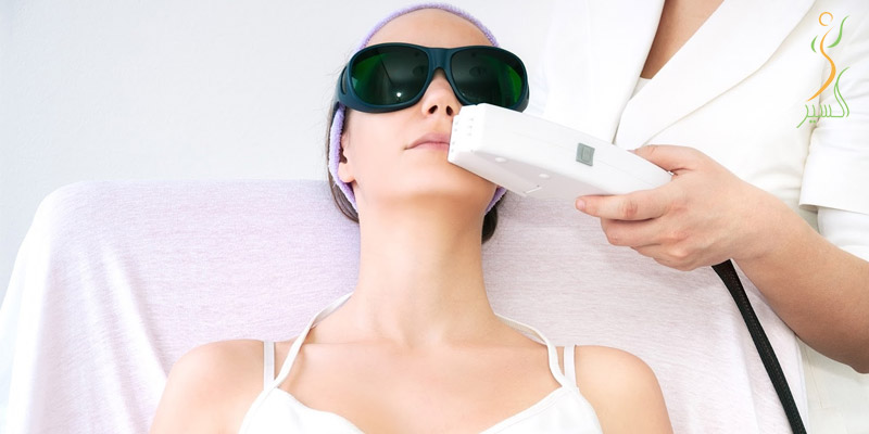 آیا مزایای لیزر موهای زائد را میدانید؟