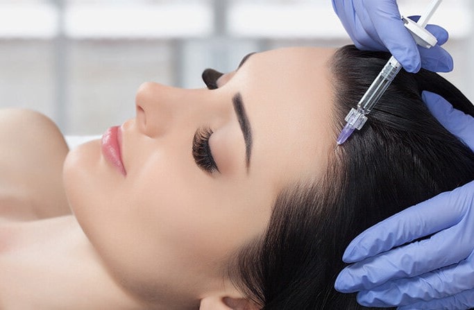 مزوتراپی مو چه فوایدی دارد ؟