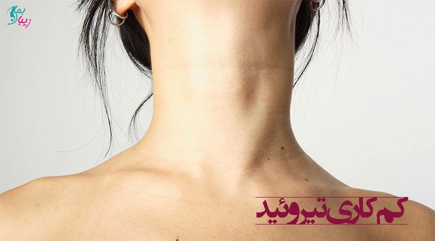 علائم و مشکلات کم کاری تیروئید به چه صورت است ؟