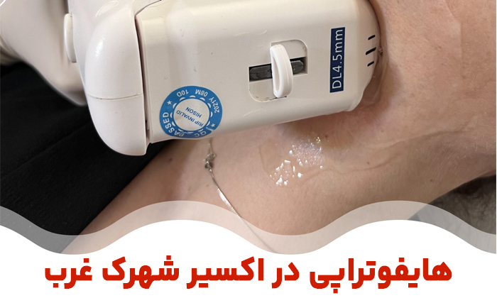 هایفوتراپی، معجزه جوانسازی پوست