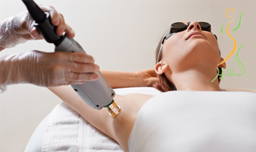 زمان مناسب برای لیزر موهای زائد