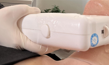 هایفوتراپی، معجزه جوانسازی پوست