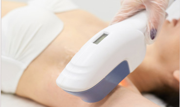 لیزر موهای زائد در اکسیر شهرک غرب