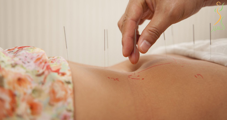 طب سوزنی  نحوه پيدايش و فلسفه آن