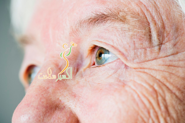 مهمتـــرین عوامل پیری زودرس پوست + روش درمان